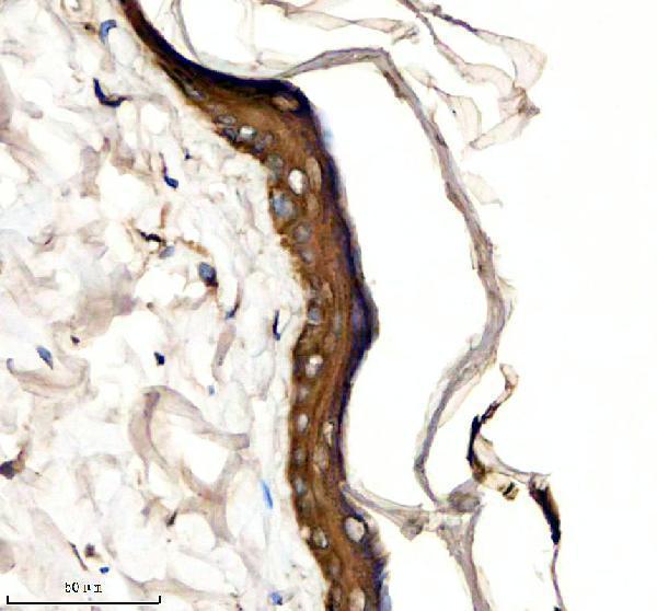 a04012 2 krt6a primary antibodies ihc testing 3