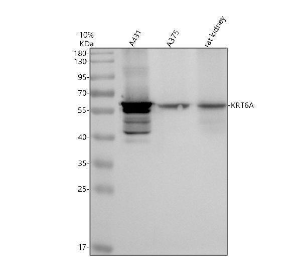 Western blot analysis of Cytokeratin 6A/KRT6A using anti-Cytokeratin 6A/KRT6A antibody (A04012-2)