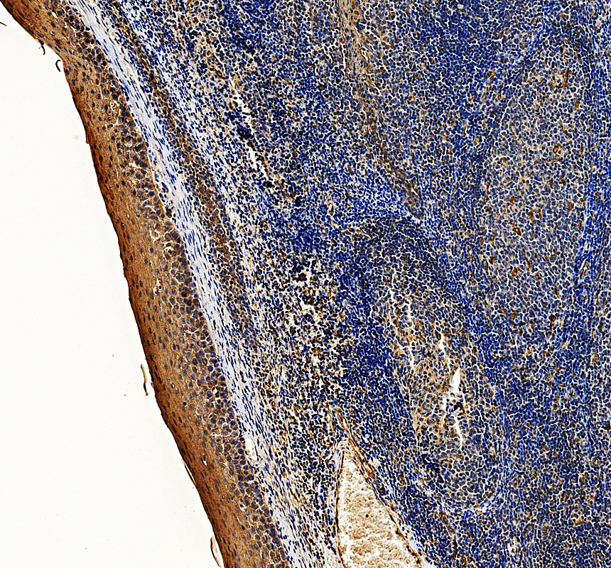 IHC analysis of KRT6A/B/C using anti-KRT6A/B/C antibody (A04012-3)