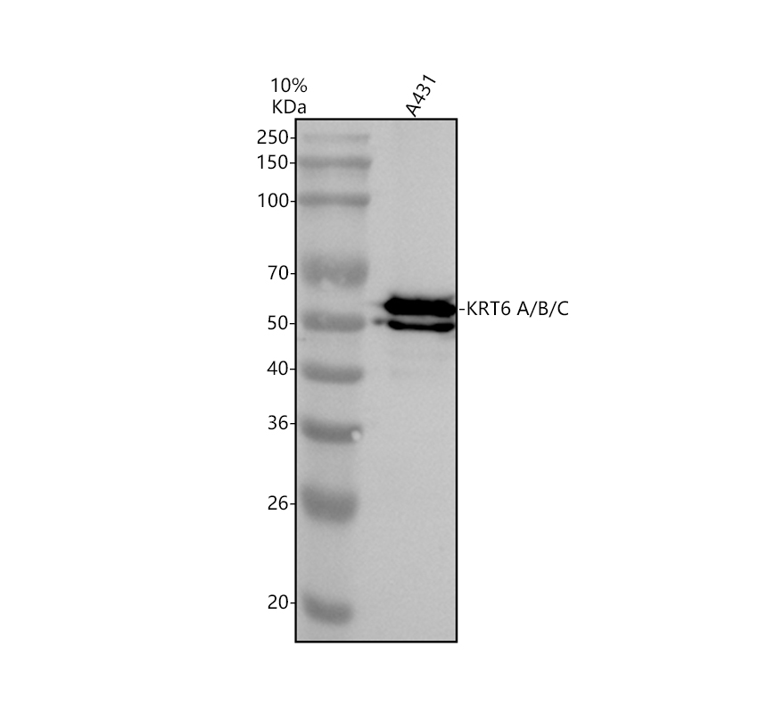 Western blot analysis of KRT6A/B/C using anti-KRT6A/B/C antibody (A04012-3)