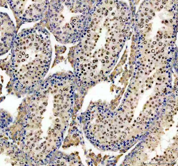 a04013 3 elac2 primary antibodies ihc testing 1
