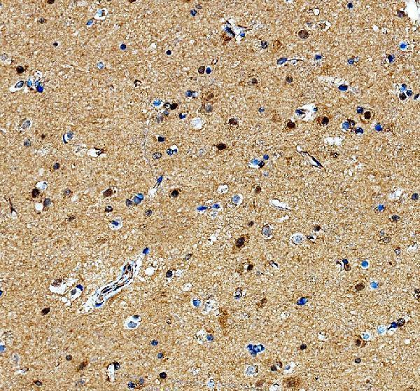 a04013 3 elac2 primary antibodies ihc testing 2