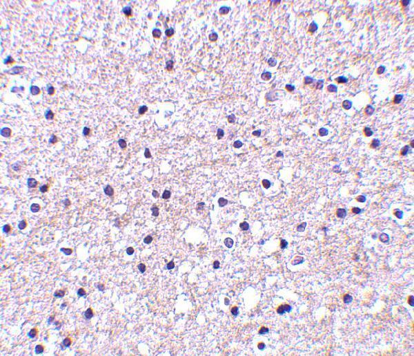 Immunohistochemistry of IEX-1 in human liver tissue with IEX-1 antibody at 2