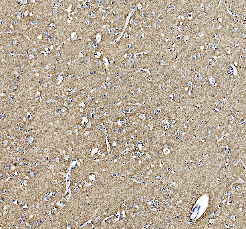 a04015 1 nfasc primary antibodies ihc testing 1