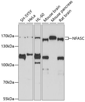 Western blot analysis of extracts of various cell lines, using NFASC antibody  at 1:1000 dilution