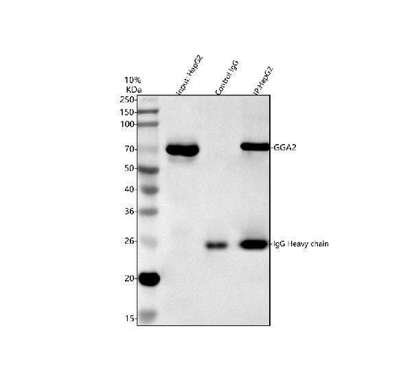  Immunoprecipitating GGA2 in HepG2 whole cell lysate