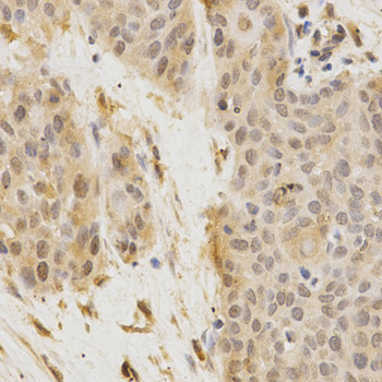 Immunofluorescence analysis of MCF-7 cells using GGA2 antibody 