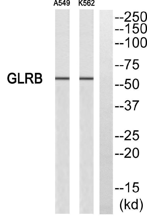 a04017 1 glrb primary antibodies wb testing 2