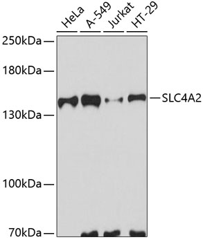 a04019 slc4a2 primary antiboties wb testing 1