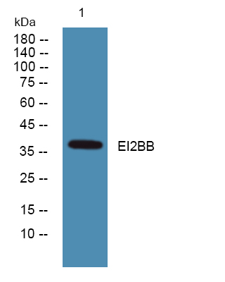 Western blot analysis of lysates from SH-SY5Y cells, primary antibody was diluted at 1:1000, 4°over night
