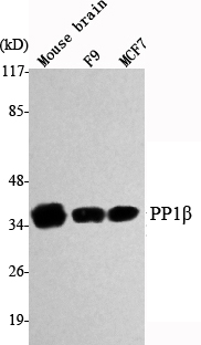 a04022 1 ppp1cb primary antibodies wb testing 1