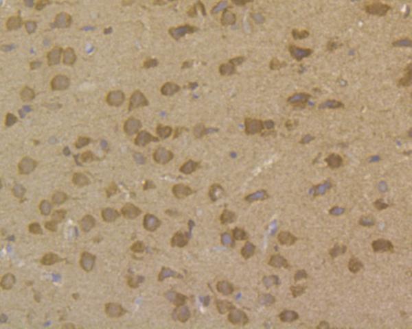Immunohistochemical analysis of paraffin-embedded rat brain tissue using anti-PPP1CB antibody