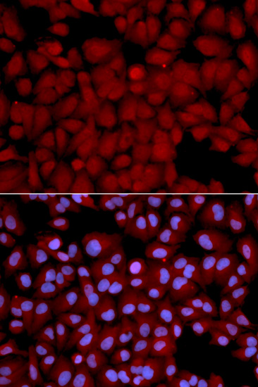 Immunofluorescence analysis of U2OS cells, using PPP1CB polyclonal antibody