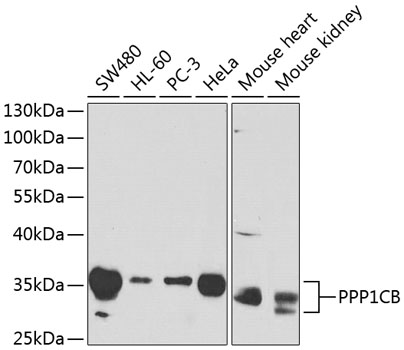 WesternBlot (WB) analysis of PPP1CB polyclonal antibody