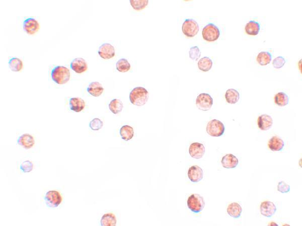Immunocytochemistry of KPNA1 in HeLa cells with KPNA1 antibody at 2