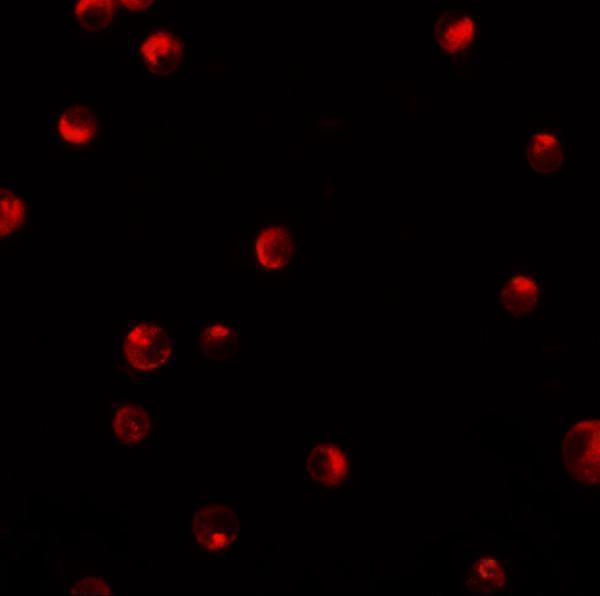Immunofluorescence of KPNA1 in K562 cells with KPNA1 antibody at 20 μg/mL