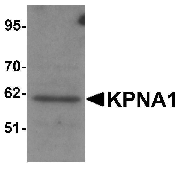 Western blot analysis of KPNA1 in Hela cell lysate with KPNA1 antibody at 1μg/mL