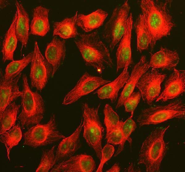  IF analysis of BOP1 using anti-BOP1 antibody (A04026-2) and anti-Beta Tubulin antibody (M01857-3)