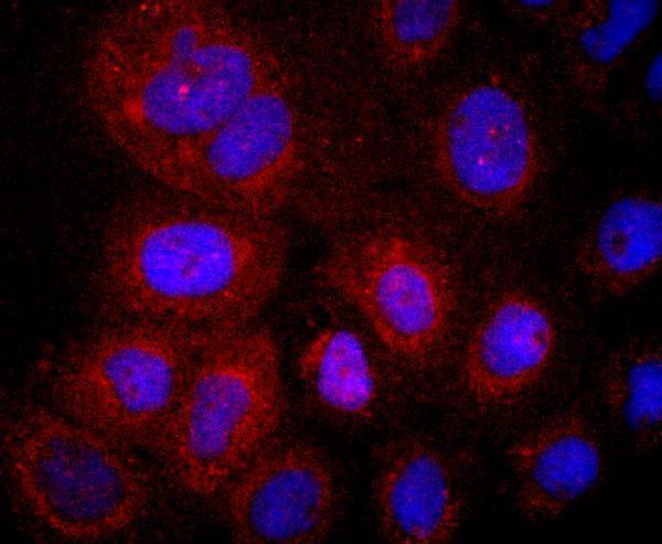 a04027 1 lyve1 primary antiboties icc testing 2