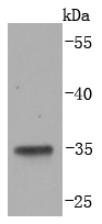 a04027 1 lyve1 primary antiboties wb testing 1