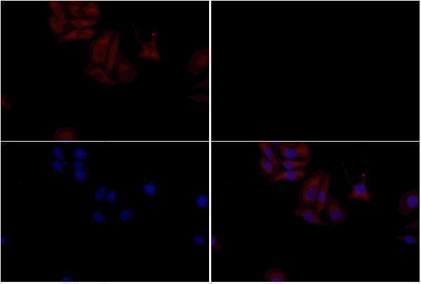 a04027 lyve1 primary antiboties if testing 3