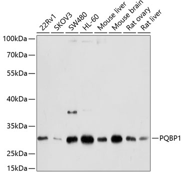 a04031 pqbp1 primary antiboties wb testing 1