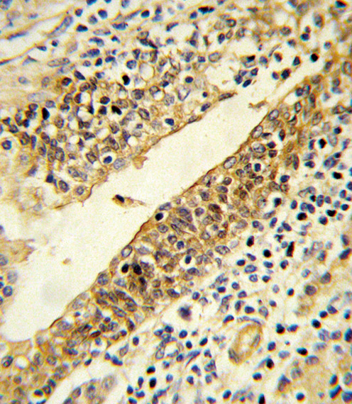 a04032 2 anti cyp51a1 antibody center ihc p testing 2