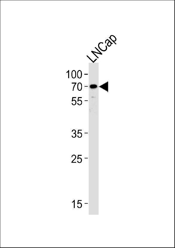 a04032 2 anti cyp51a1 antibody center wb testing 1