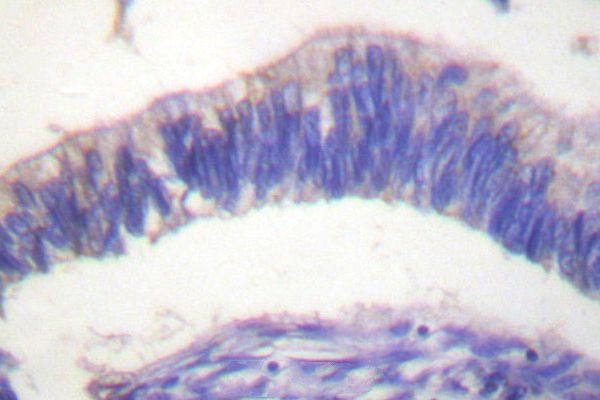 a04036 1 nck2 primary antiboties ihc testing 2