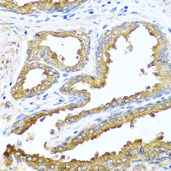 Immunohistochemistry of paraffin-embedded human prostate using NCK2 antibody  at dilution of 1:100 