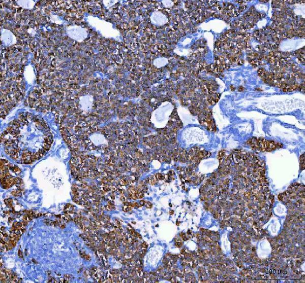 IHC analysis of MELK using anti-MELK antibody (A04038-2)