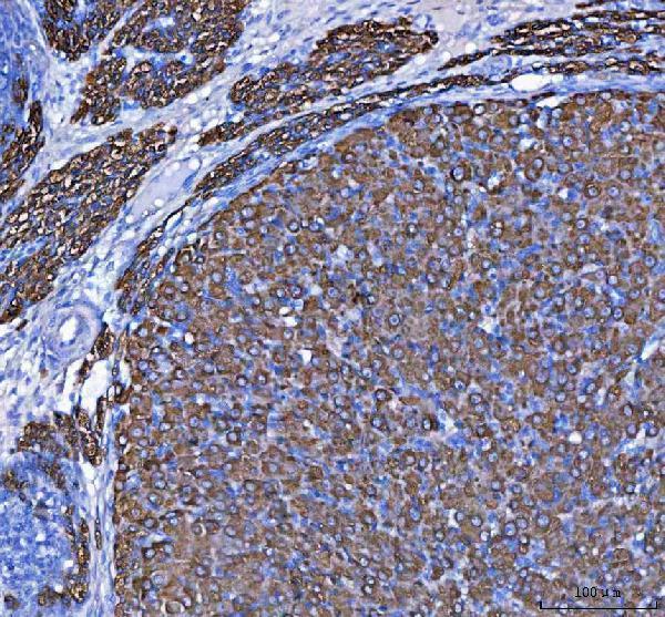  IHC analysis of MELK using anti-MELK antibody (A04038-2)