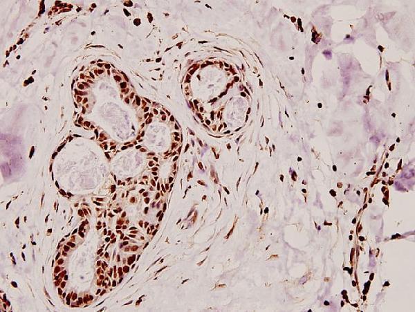 a04038 melk primary antiboties ihc testing 2