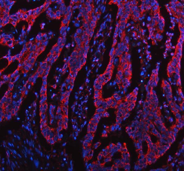 a04039 2 tomm20 primary antibodies if testing 2