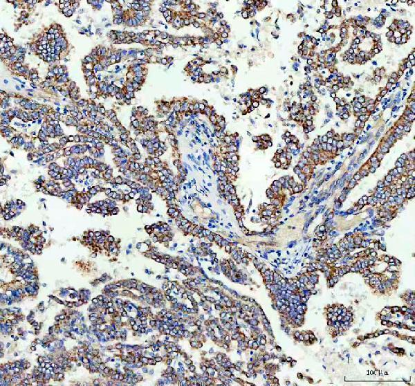 IHC analysis of TOMM20 using anti-TOMM20 antibody (A04039-2)