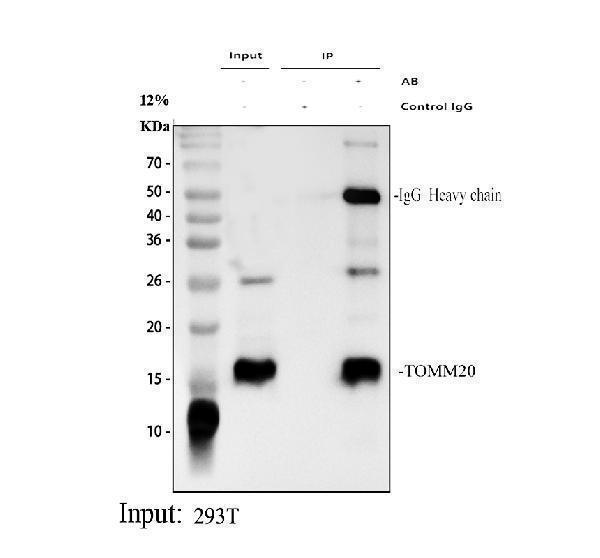 a04039 2 tomm20 primary antibodies ip testing 1