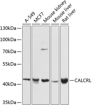 a04042 calcrl primary antiboties wb testing 1