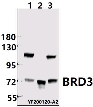 Western blot (WB) analysis of BRD3 pAb at 1:1000 dilution
Lane1:SGC7901  whole cell lysate(40ug)
Lane2:HEK293T whole cell lysate(40ug)
Lane3:Jurkat whole cell lysate(40ug)