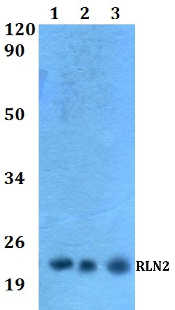 a04045 rln2 primary antiboties wb testing 1