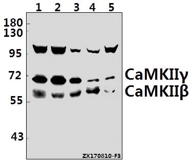 Western blot (WB) analysis of CaMKIIβ/γ (R631) pAb at 1:500 dilution
Lane1:U-87MG whole cell lysate(40ug)
Lane2:PC3 whole cell lysate(40ug)
Lane3:A549 whole cell lysate(40ug)
Lane4:H9C2 whole cell lysate(40ug)
Lane5:CT26 whole cell lysate(40ug)