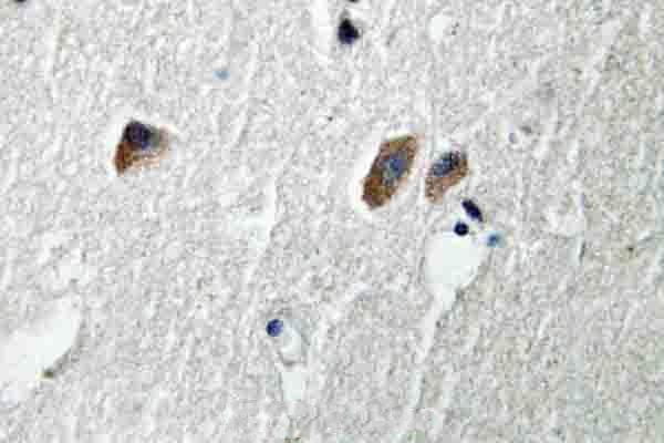 Immunohistochemistry (IHC) analyzes of CaMKIIβ/γ/δ (S280) pAb in paraffin-embedded human brain tissue