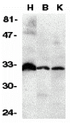 a04048 1 tnfrsf6b primary antibodies wb testing 1