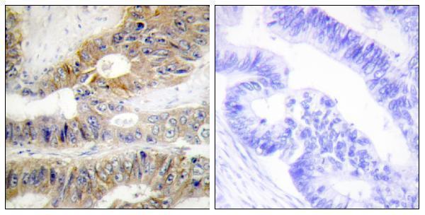 a04048 tnfrsf6b primary antibodies ihc testing 5