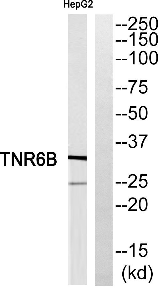 Western blot analysis of TNFRSF6B Antibody