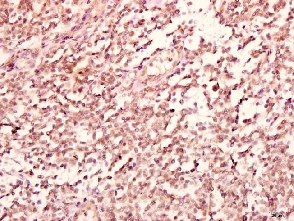 a04049 gabrb2 primary antiboties ihc testing 2