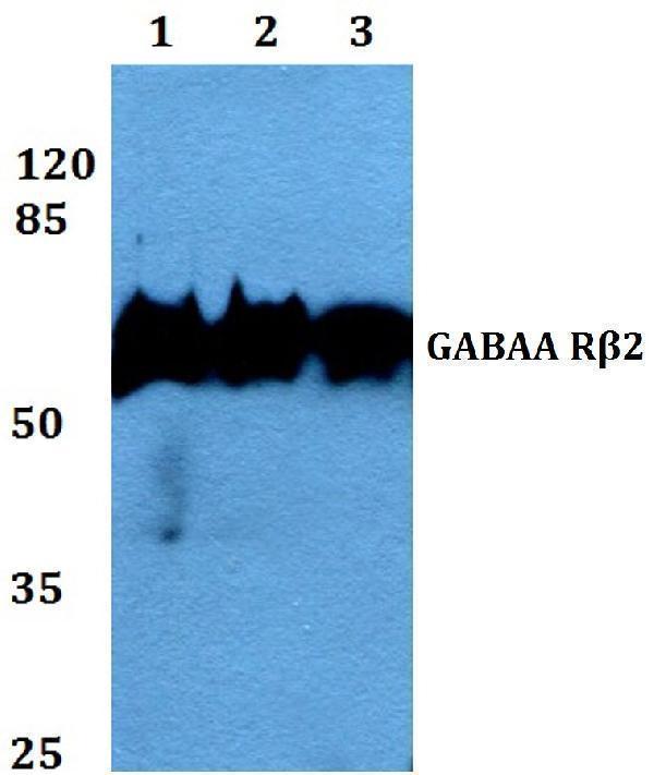 a04049 gabrb2 primary antiboties wb testing 1