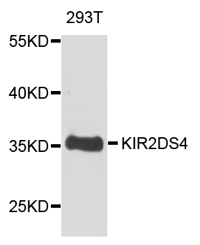 Western blot analysis of extract of various cells, using KIR2DS4 antibody