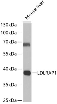 a04054 ldlrap1 primary antiboties if testing 2
