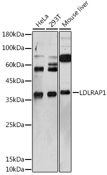 a04054 ldlrap1 primary antiboties wb testing 1
