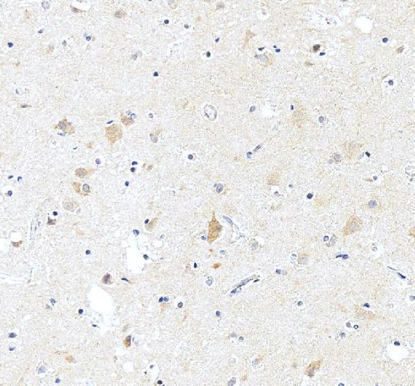 a04055 1 asic2 primary antibodies ihc testing 1